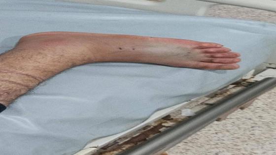خطير جدا..لزوار المناطق الجبلية