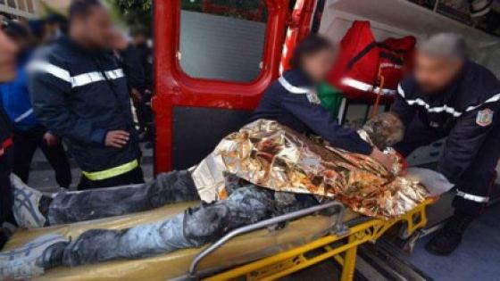 الناظور: وفاة شخص بسبب مضاعفات الحروق العمدية التي تعرض لها الاثنين